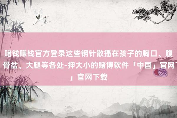 赌钱赚钱官方登录这些钢针散播在孩子的胸口、腹腔、骨盆、大腿等各处-押大小的赌博软件「中国」官网下载